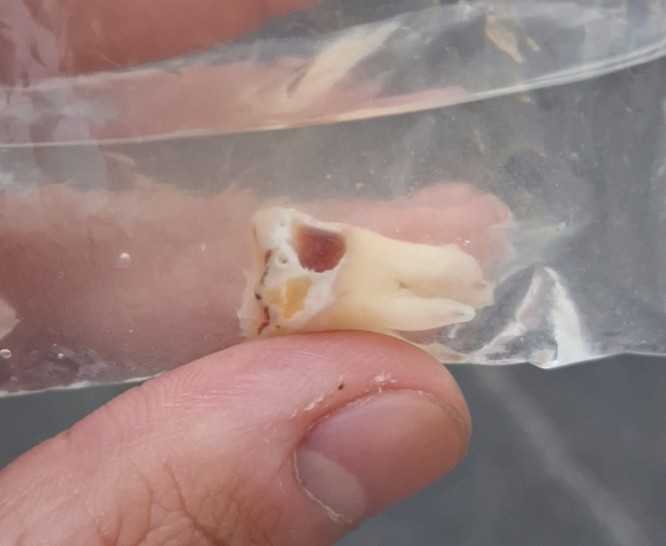 置中圖片